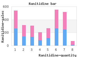 cheap ranitidine 300 mg line