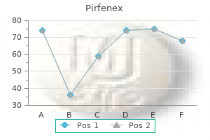 generic pirfenex 200 mg with mastercard