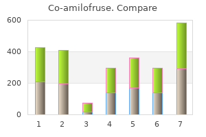 generic 40mg/5mg co-amilofruse mastercard