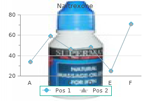 naltrexone 50mg overnight delivery