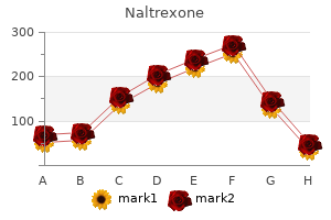 buy naltrexone 50mg low cost