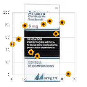 Schwartz Newark syndrome