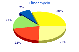 150mg clindamycin for sale