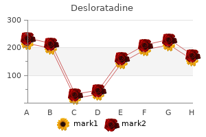 buy desloratadine 5 mg line