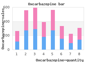 order oxcarbazepine 150mg visa